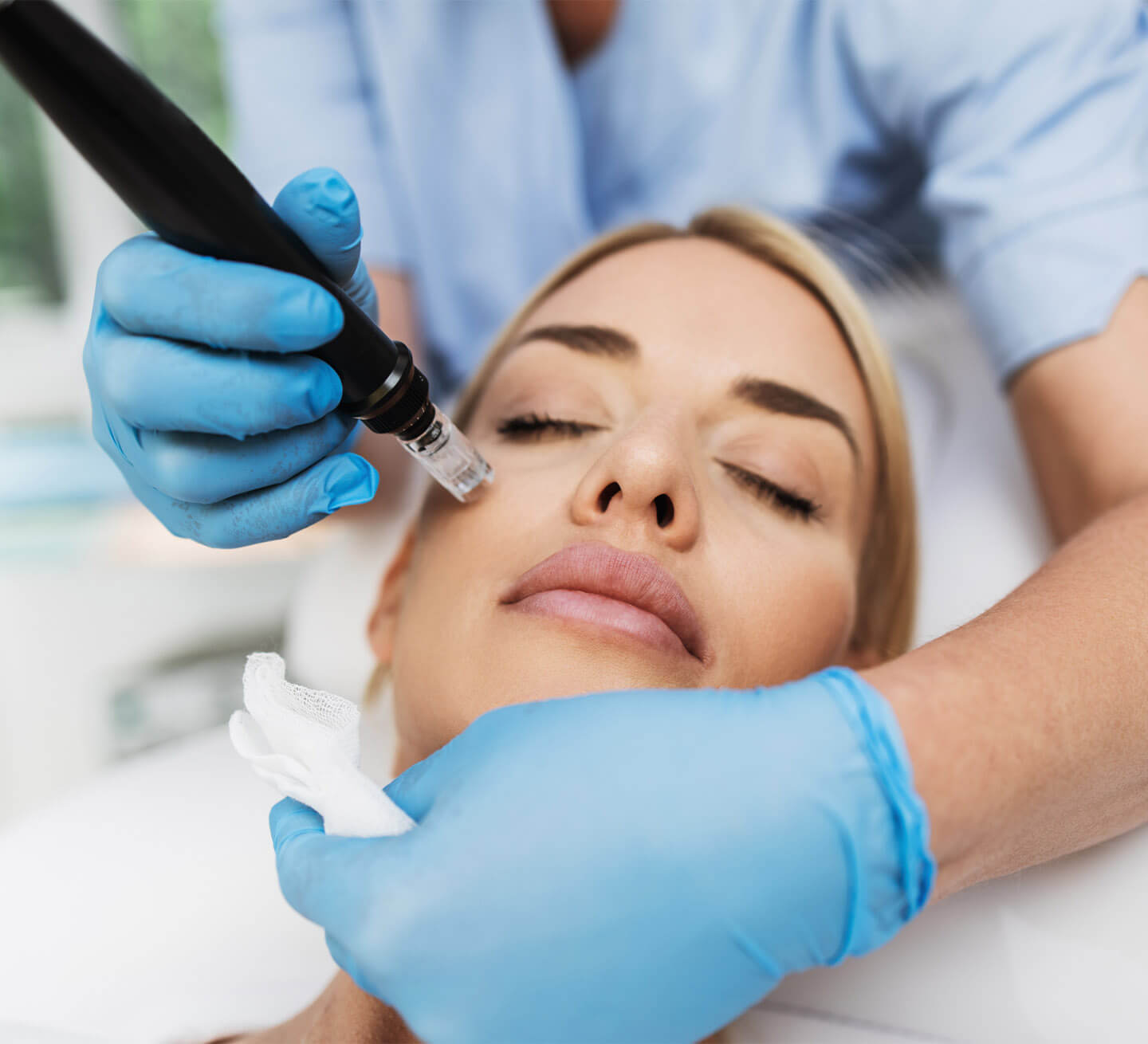 Baltimore Microneedling