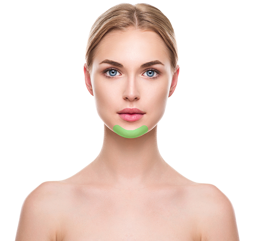 chin hair removal